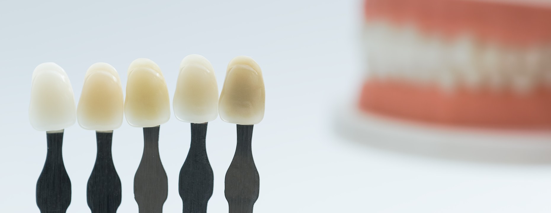 치아 색 참고 이미지 — 밝은 색부터 어두운 색까지 나열한 치아 색 견본과 뒤편의 치아 모형